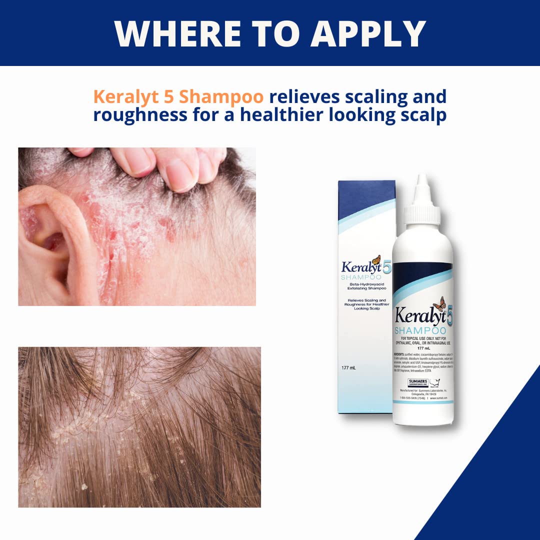 Keralyt 5% Shampoo
