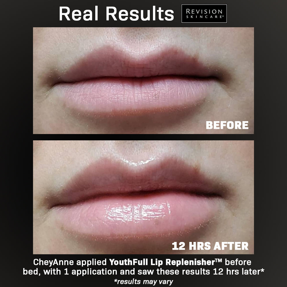 Revision Youthful Lip Replenisher