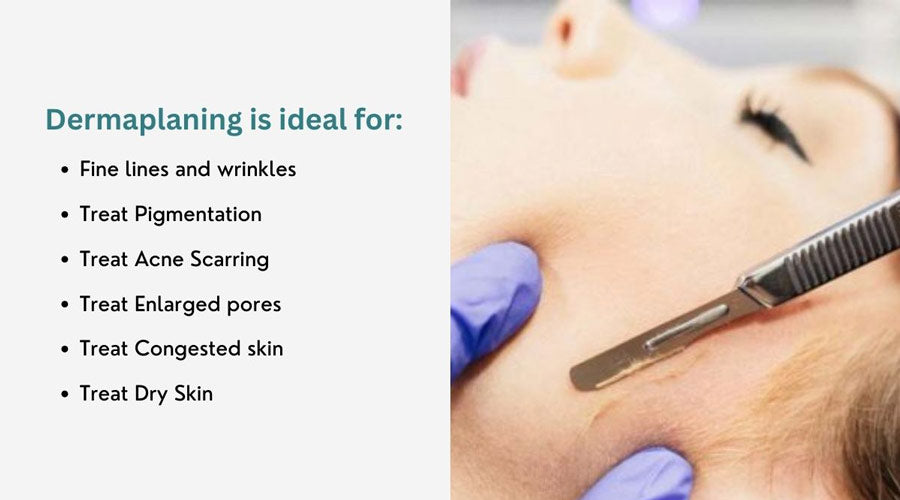 Elevate Your Skincare with Dermaplaning Benefits
