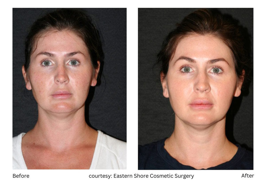 Applications of EVO Light Series