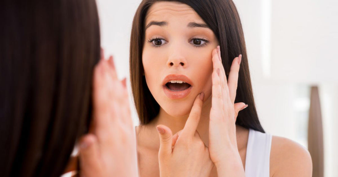 Decoding Adult Acne: Here’s What Might Be Causing Your Breakouts