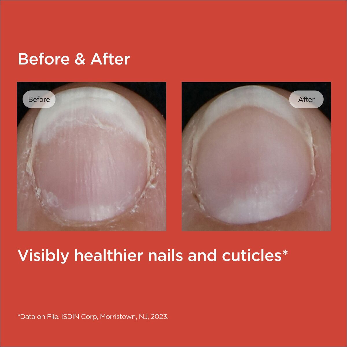 ISDIN Si-Nails
