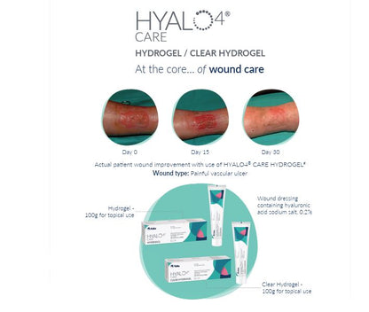 HYALO4 Care Clear Hydrogel