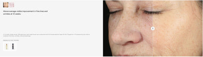 Hydrinity RetaXome Daily Retinal Hydrator