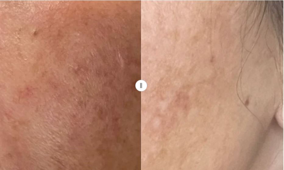 Hydrinity Vivid Brightening Serum