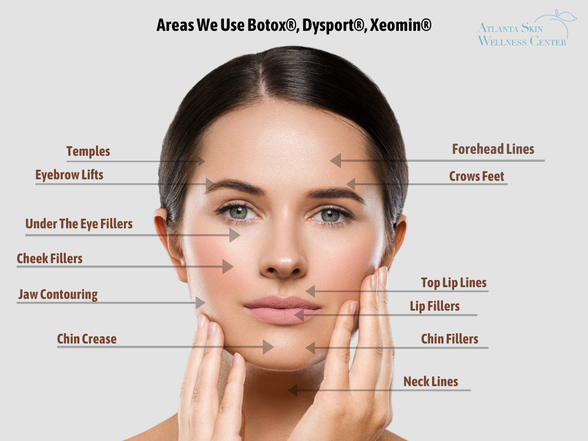 How we use Botox®, Dysport®, Xeomin® 