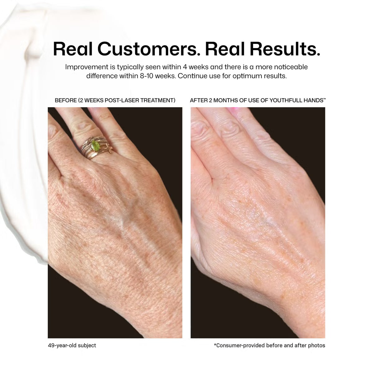 Revision Youthful Hands