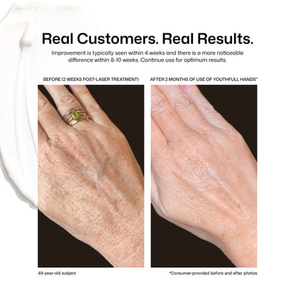 Revision Youthful Hands