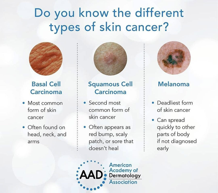 Types of Skin Cancer